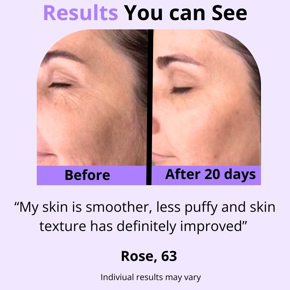 Jova: Advanced Skin Tightening Wand US