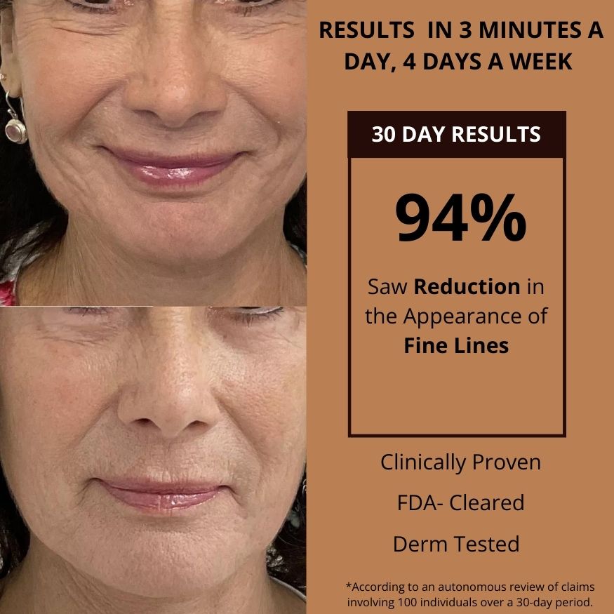 Jova | Advanced RF Skin Firming Device